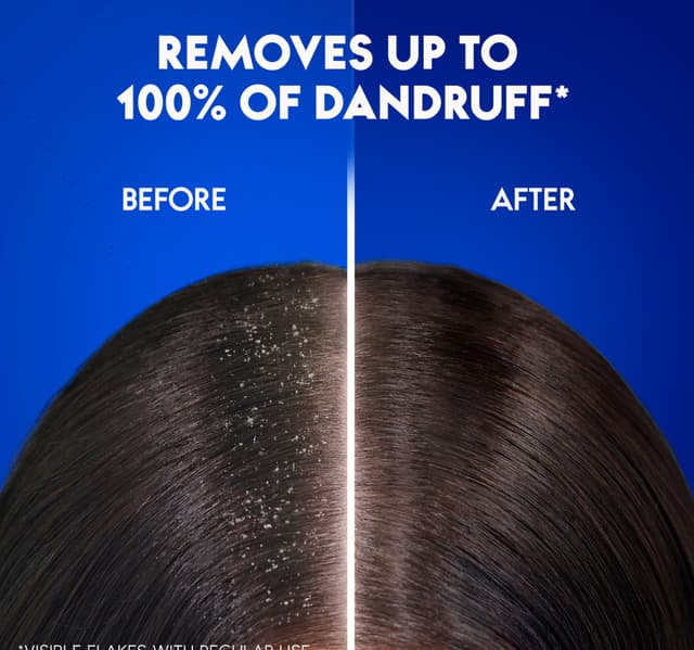 Head Shoulders Smooth Silky Antidandruff Shampoo For Dry And Frizzy Hair