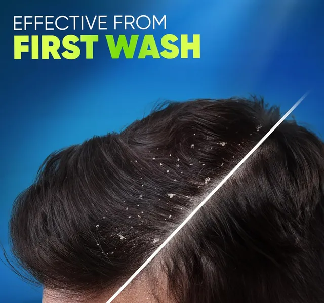 Head Shoulders Deep Clean Oily Scalp Citrus Anti Dandruff Shampoo 400 Ml