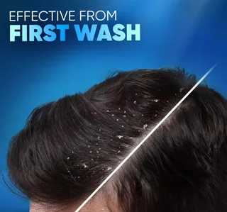 Head Shoulders Deep Clean Flaky Scalp Sea Minerals Anti Dandruff Shampoo 400 Ml