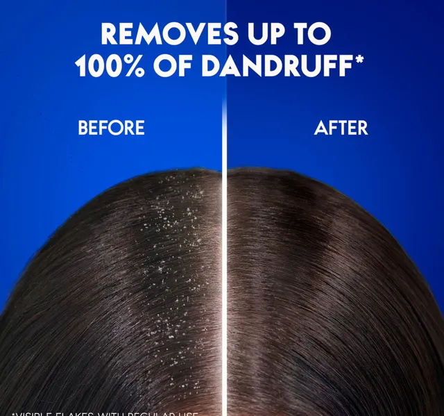 Head Shoulders Classic Clean Anti Dandruff Shampoo Value Pack 2 X 350 Ml